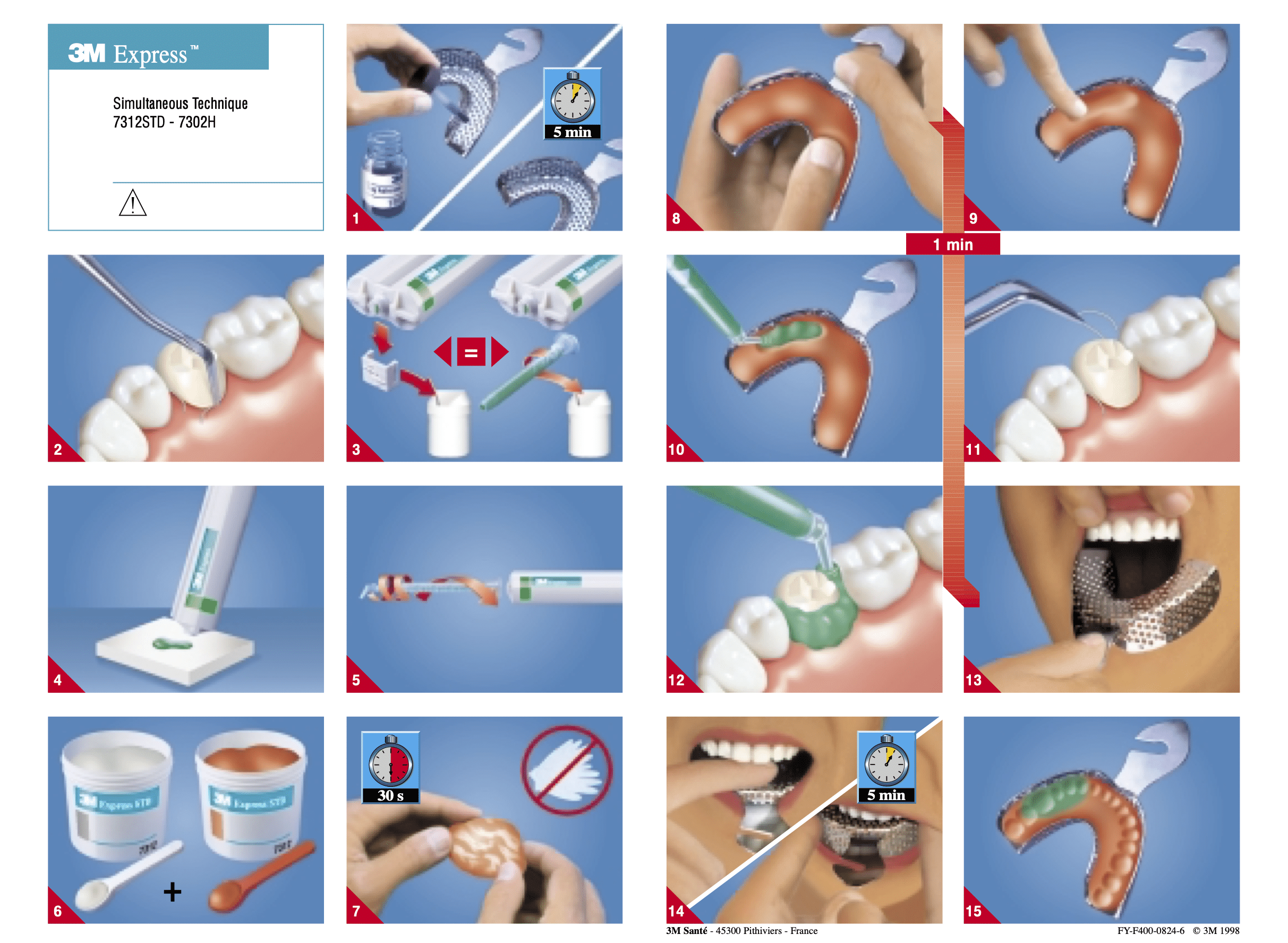 Material de Impresión 3M™ Express™ Putty STD - Solventum