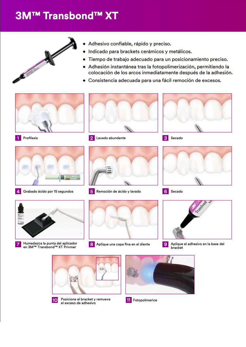 Adhesivo para Fotocurado 3M™ Transbond™ XT, 4 Jeringas de 4g - Solventum