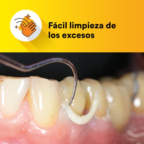 Cemento Resina Relyx Universal - Solventum